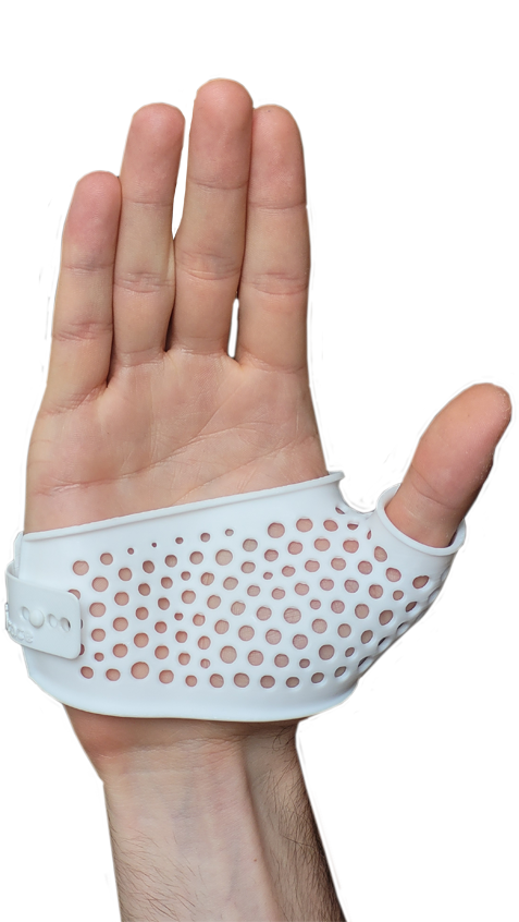 rhizarthrose V1 right