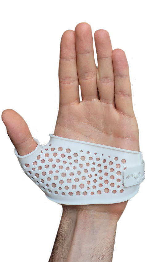 rhizarthrose V1 left