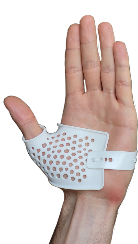 left rhizarthrose V2