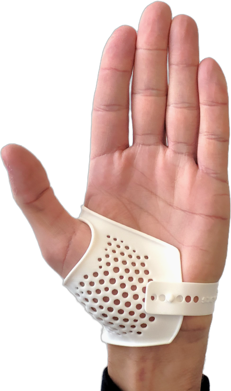 right rhizarthrose V4